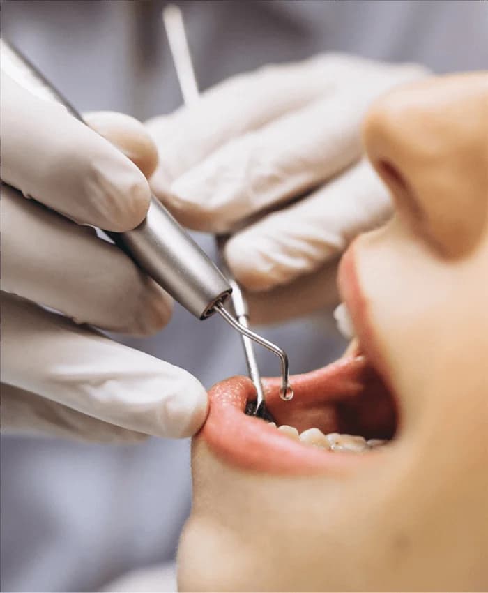 طب الأسنان التحفظي والتجميلي