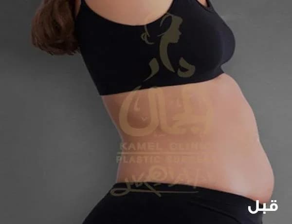 قبل — نحت رباعى الابعاد