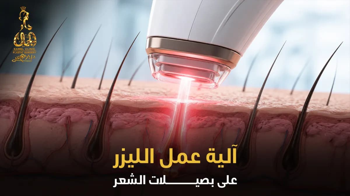 إنفوغرافيك يوضح آلية عمل الليزر على بصيلات الشعر