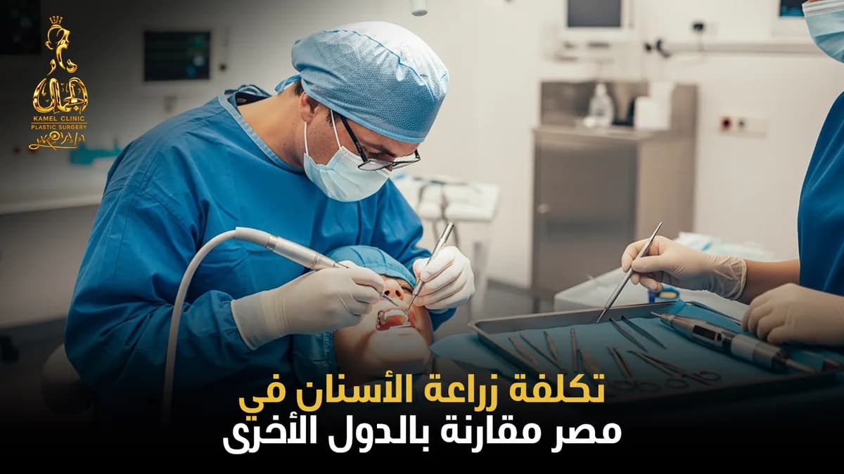 تكلفة زراعة الأسنان: الدليل الشامل للأسعار والعوامل والمقارنة 2026