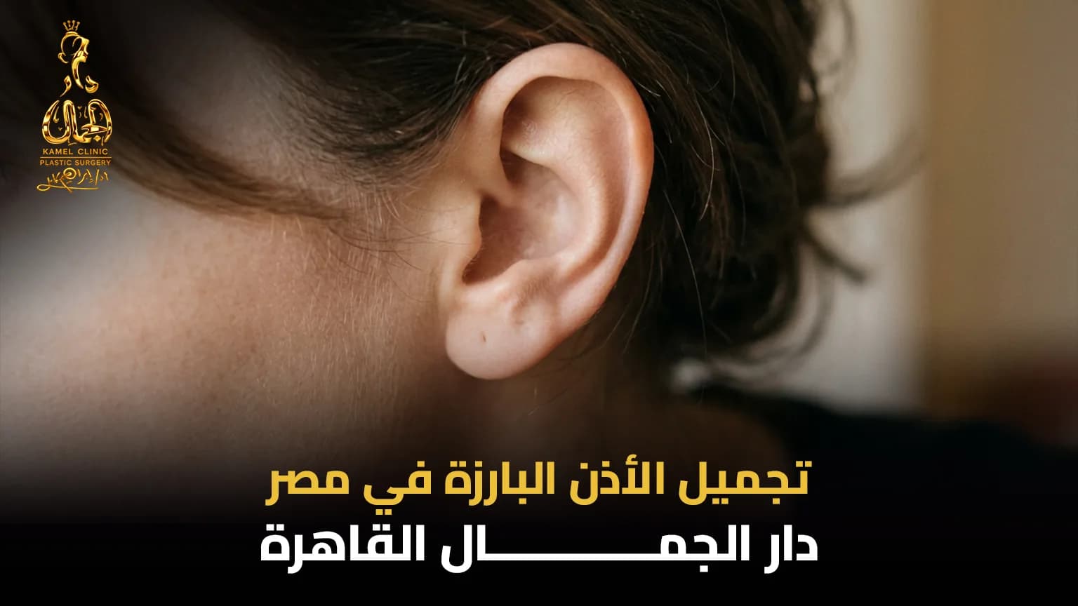 تجميل الأذن البارزة في مصر | دليل 2026 - دار الجمال