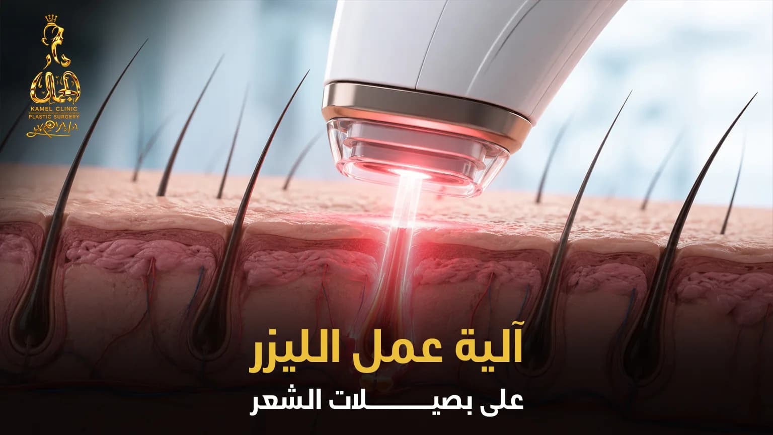إنفوغرافيك يوضح آلية عمل الليزر على بصيلات الشعر