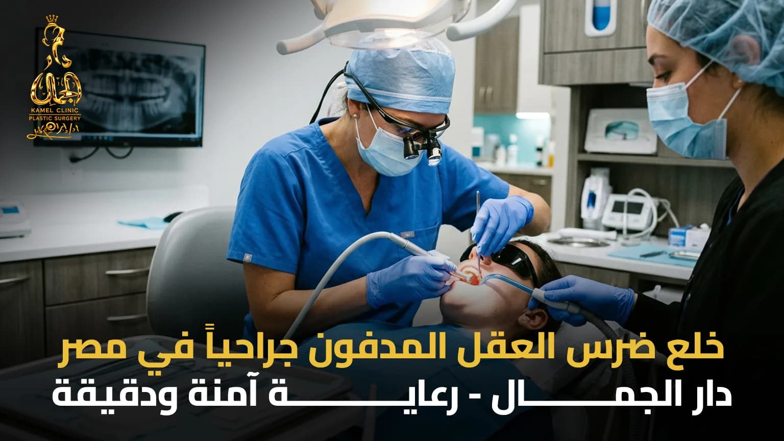 خلع ضرس العقل المدفون جراحيا في مصر